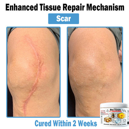 🎁Limited time extra 30% discount🎁 TOD𝑨𝑯OF® 𝑩𝒆𝐞 𝑽𝒆𝒏𝒐𝒎 𝑴𝒖𝒍𝒕𝒊-𝑺𝒚𝒎𝒑𝒕𝒐𝒎 𝑺𝒌𝒊𝒏 𝑻𝒓𝐞𝒂𝒕𝒎𝒆𝒏𝒕 𝑪𝒓𝒆𝒂𝒎