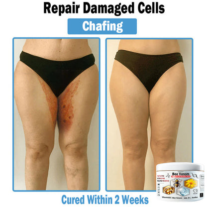 🎁Limited time extra 30% discount🎁 TOD𝑨𝑯OF® 𝑩𝒆𝐞 𝑽𝒆𝒏𝒐𝒎 𝑴𝒖𝒍𝒕𝒊-𝑺𝒚𝒎𝒑𝒕𝒐𝒎 𝑺𝒌𝒊𝒏 𝑻𝒓𝐞𝒂𝒕𝒎𝒆𝒏𝒕 𝑪𝒓𝒆𝒂𝒎