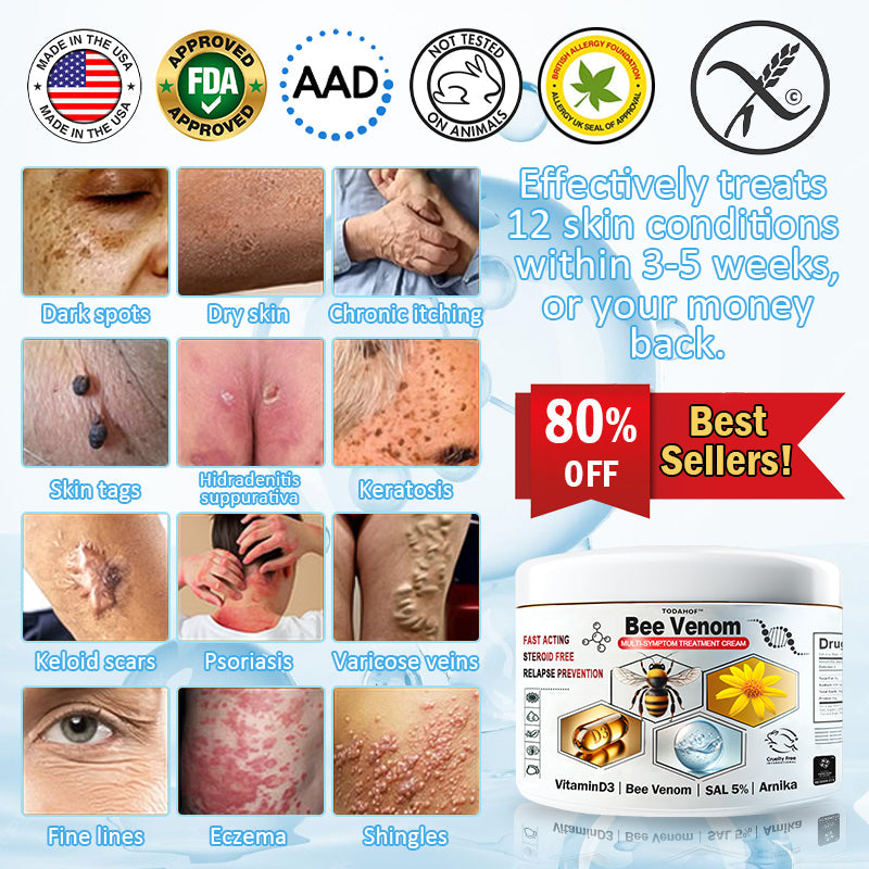 🎁Limited time extra 30% discount🎁 TOD𝑨𝑯OF® 𝑩𝒆𝐞 𝑽𝒆𝒏𝒐𝒎 𝑴𝒖𝒍𝒕𝒊-𝑺𝒚𝒎𝒑𝒕𝒐𝒎 𝑺𝒌𝒊𝒏 𝑻𝒓𝐞𝒂𝒕𝒎𝒆𝒏𝒕 𝑪𝒓𝒆𝒂𝒎