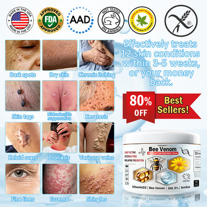 🎁Limited time extra 30% discount🎁 TOD𝑨𝑯OF® 𝑩𝒆𝐞 𝑽𝒆𝒏𝒐𝒎 𝑴𝒖𝒍𝒕𝒊-𝑺𝒚𝒎𝒑𝒕𝒐𝒎 𝑺𝒌𝒊𝒏 𝑻𝒓𝐞𝒂𝒕𝒎𝒆𝒏𝒕 𝑪𝒓𝒆𝒂𝒎